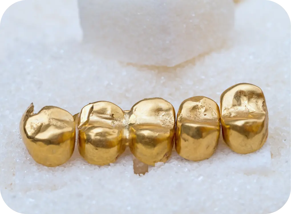 Ankauf von Zahngold in Wien